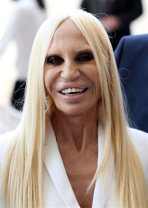 anni versace donatella|donatella versace face what happened.